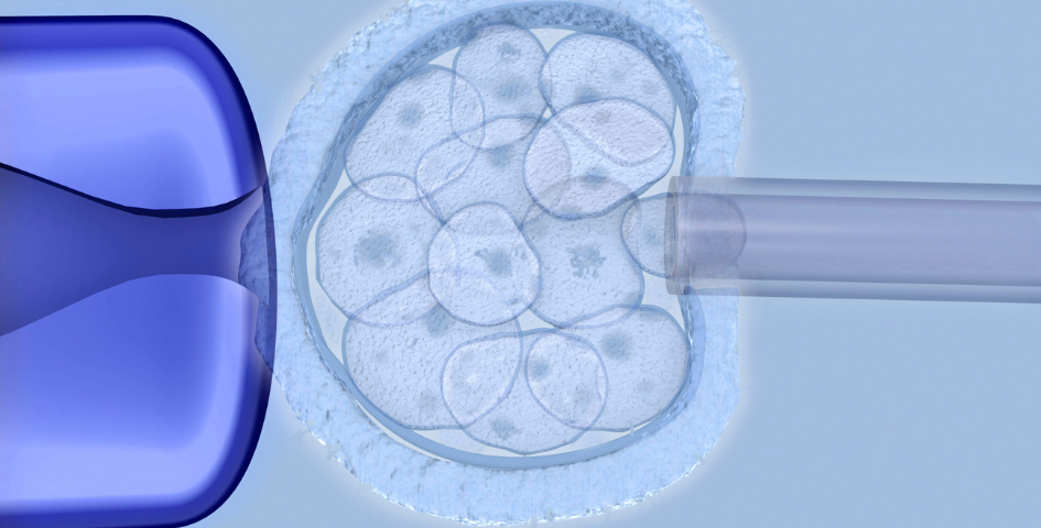 What Is PGT GENESIS Fertility Reproductive Medicine